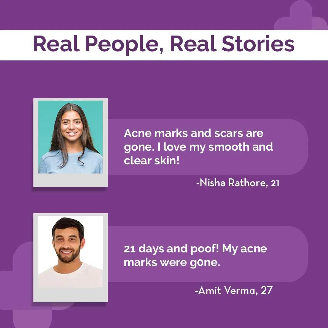 The Derma Co. 10% Niacinamide Face Serum – 30ml | Acne Marks & Oil Control Serum for Oily, Acne-Prone Skin