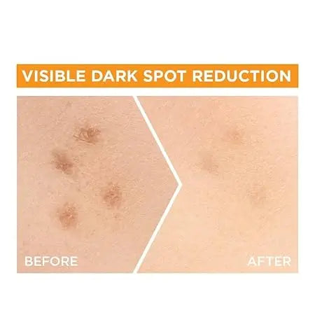 Garnier Bright Complete 30X Vitamin C Booster Serum 15 ml | Lightweight Gel for Brightening & Spot Reduction