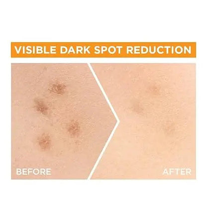 Garnier Bright Complete 30X Vitamin C Booster Serum 15 ml | Lightweight Gel for Brightening & Spot Reduction