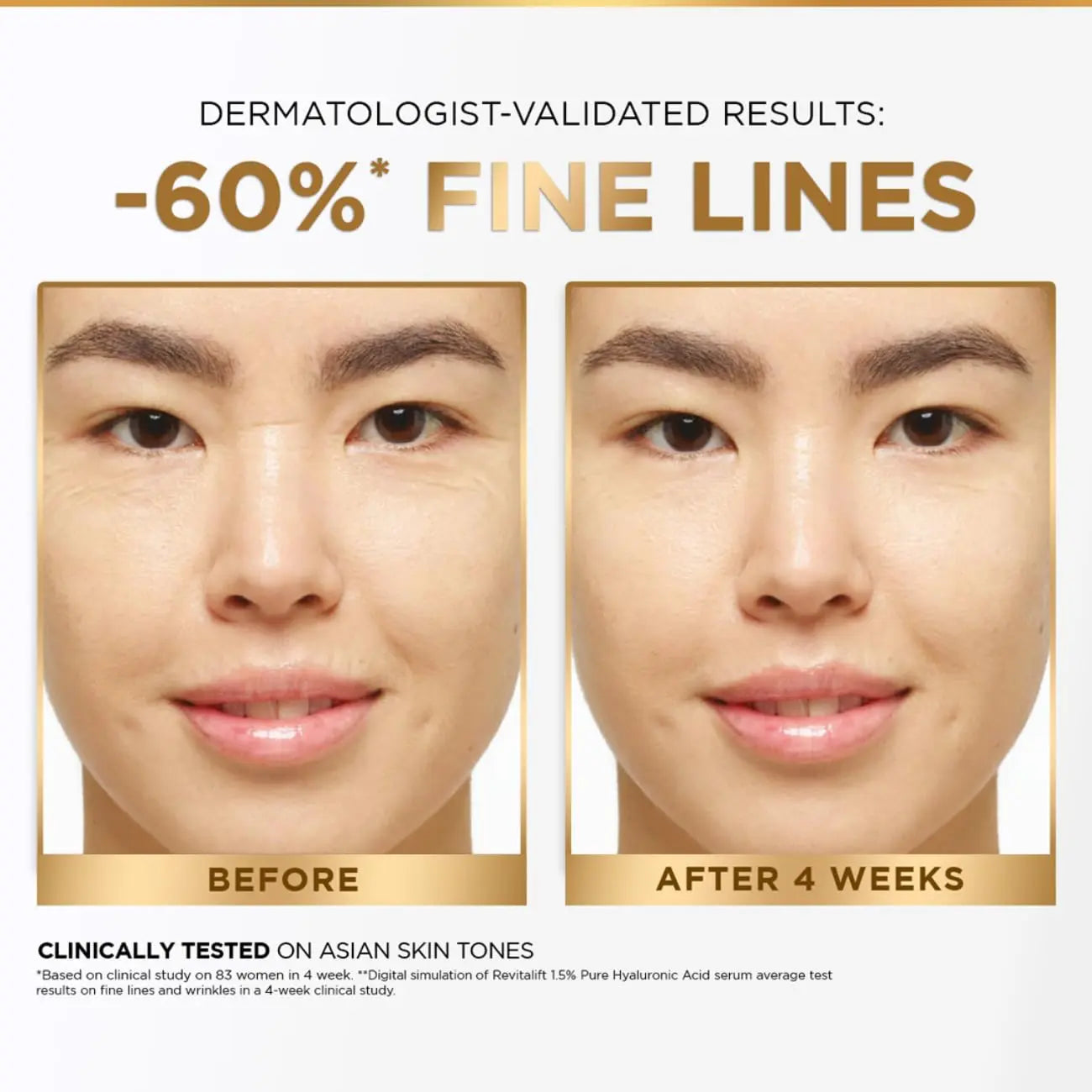 L'Oréal Paris Revitalift Serum 15ml | 1.5% Hyaluronic Acid | Hydrating & Plumping Face Serum for Glowing, Smooth Skin