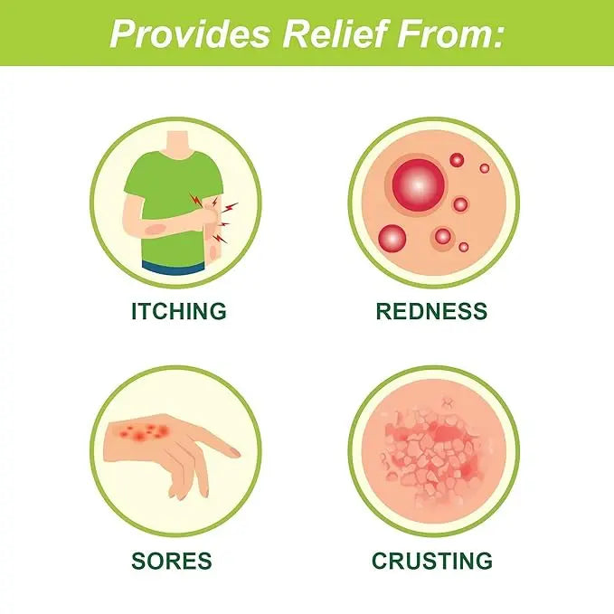 Tetmosol Monosulfiram Medicated Soap 100gm (Pack of 2) – Antibacterial Soap for Skin Protection & Itch Relief