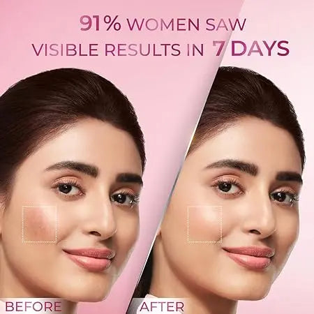 POND'S Anti-Pigmentation Serum 28ml | 12% Gluta-Niacinamide Complex | Reduces Pigmentation from Day 7 | Bright & Flawless Skin