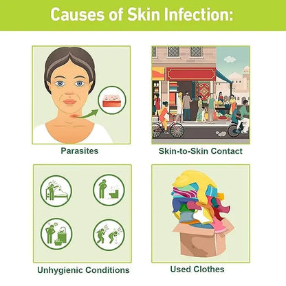 Tetmosol Monosulfiram Medicated Soap 100gm (Pack of 2) – Antibacterial Soap for Skin Protection & Itch Relief