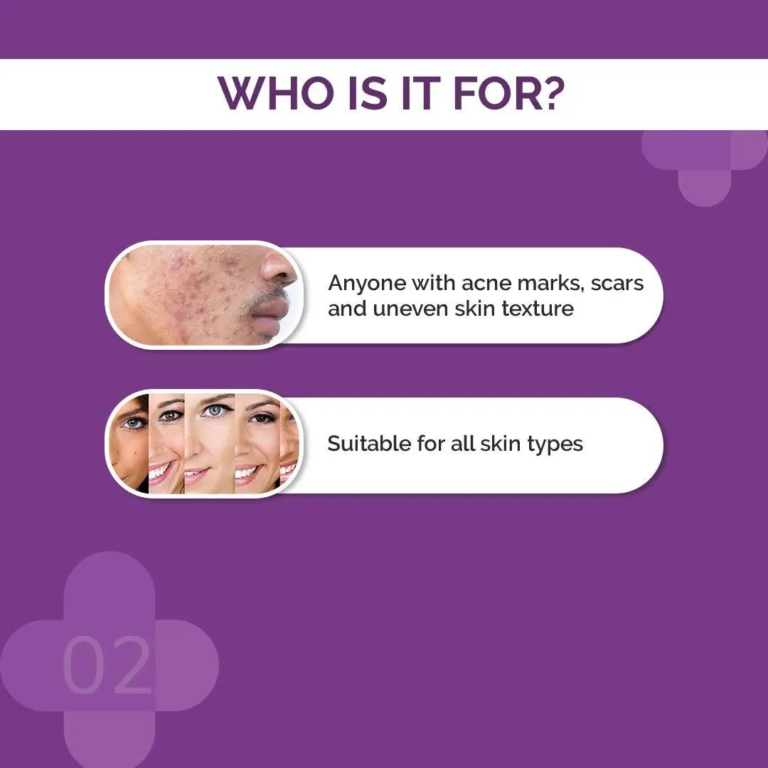 The Derma Co. 10% Niacinamide Face Serum – 30ml | Acne Marks & Oil Control Serum for Oily, Acne-Prone Skin